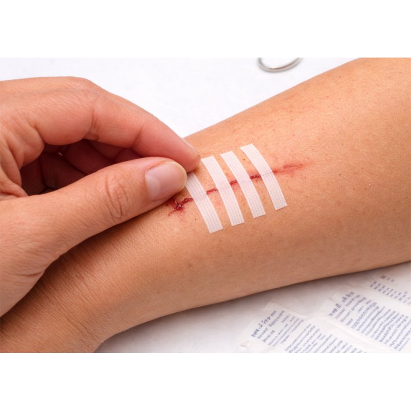 FIRST AID ONLY wondsluitstrips, steriel, wit, 140 stuks